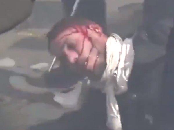 Fransa'da bir eylemci polisler tarafından dövüldü