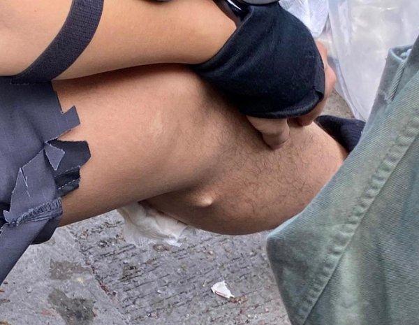 Çinli protestocunun attığı ateşli ok polise saplandı