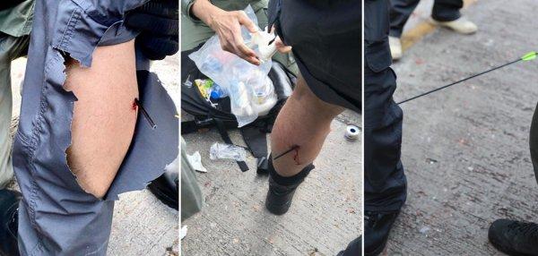 Çinli protestocunun attığı ateşli ok polise saplandı