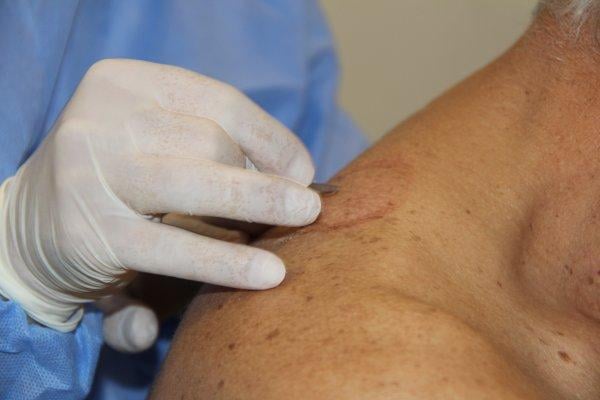 Mersinliler hacamata yöneldi