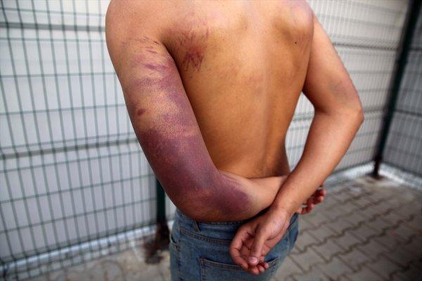 Yunan askeri göçmenleri silahla dövdü