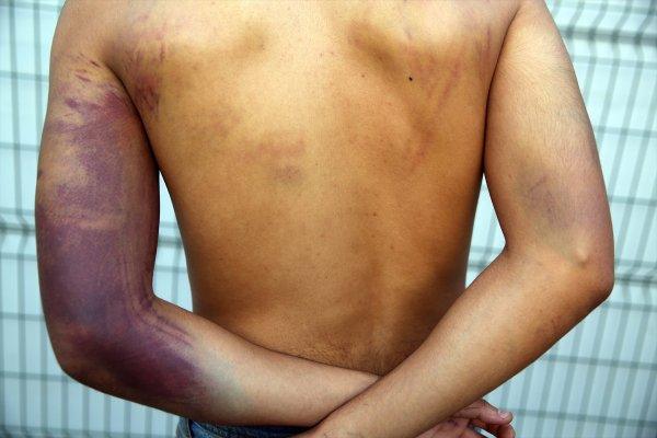 Yunan askeri göçmenleri silahla dövdü