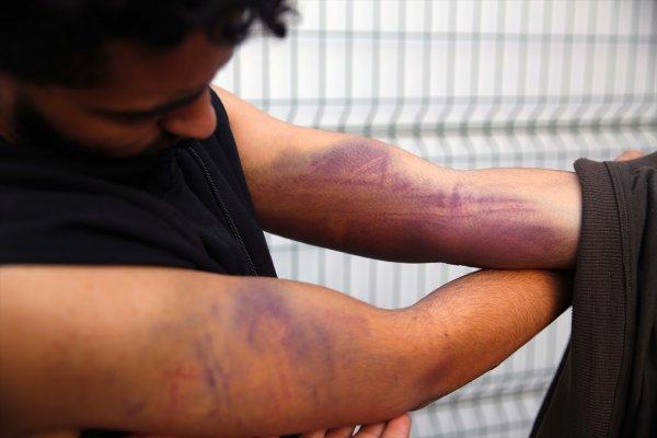 Yunan askeri göçmenleri silahla dövdü