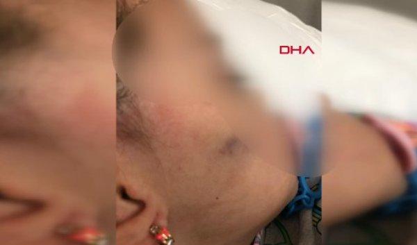 Anaokulunda işkence iddiası