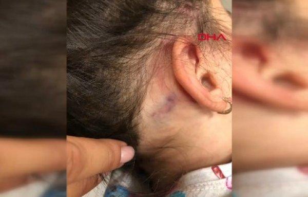 Anaokulunda işkence iddiası