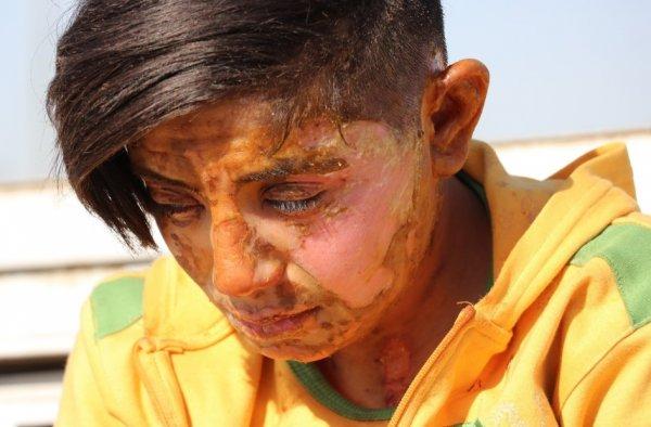 Telefonunu çaldığı genç kızı yakan cani yakalandı