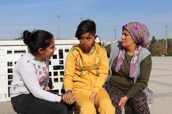 Telefonunu çaldığı genç kızı yakan cani yakalandı