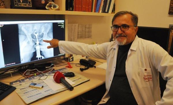 Bodrum'da dikiş iğnesi yutan kadın ameliyat oldu