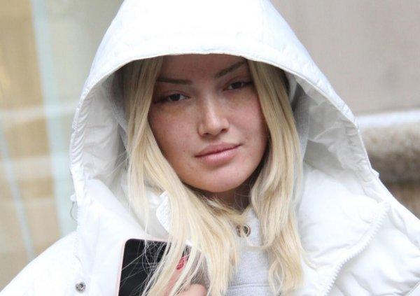 Danla Bilic gözlerinden estetik oldu