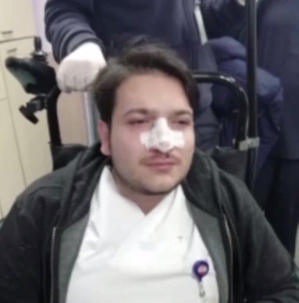 Randevusuz hasta doktorun burnunu kırdı
