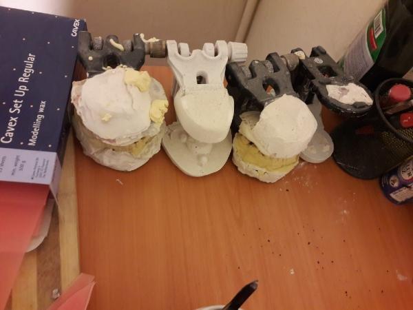 Sahte dişçi yakalandı, muayenehanesi mühürlendi