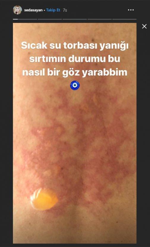 Seda Sayan, hastanelik oldu