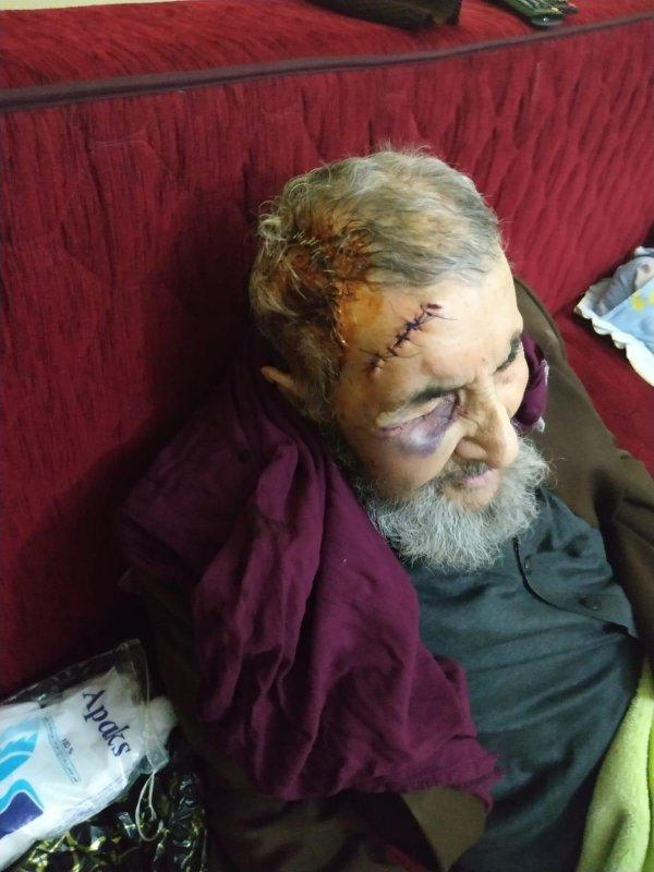 93 yaşındaki adam evinde darbedilerek parası çalındı