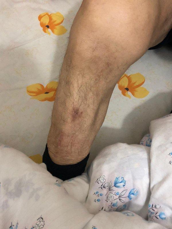 93 yaşındaki adam evinde darbedilerek parası çalındı