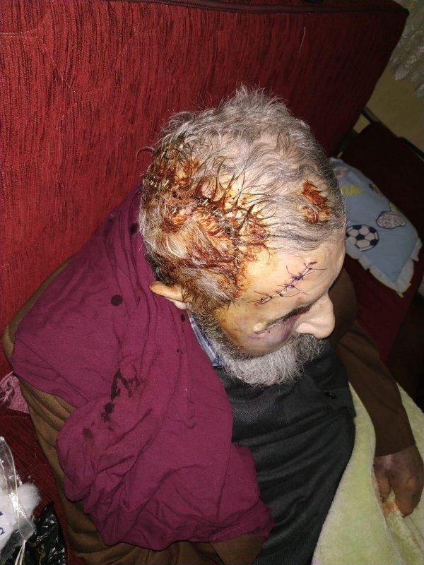 93 yaşındaki adam evinde darbedilerek parası çalındı