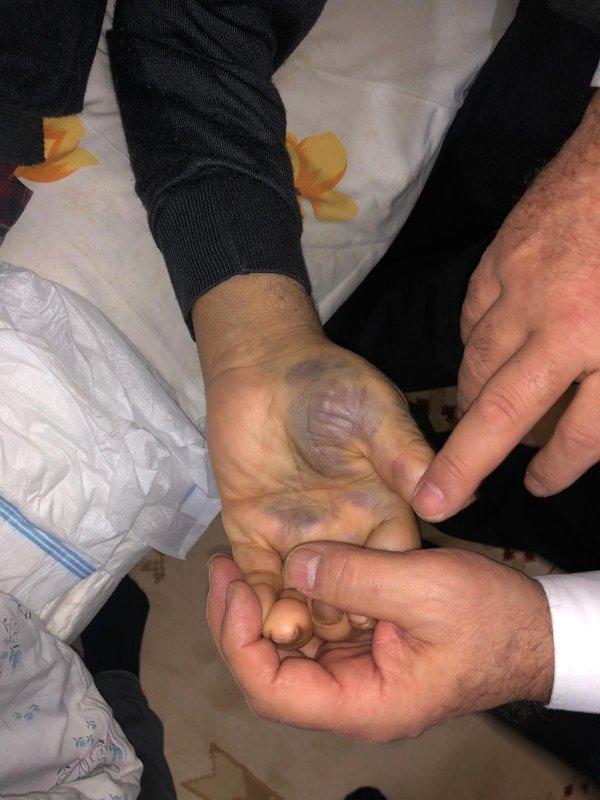 93 yaşındaki adam evinde darbedilerek parası çalındı