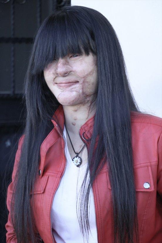 Erdoğan'ın sözleri Berfin'i mutlu etti