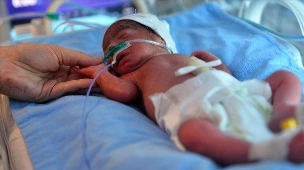 Mersin'de yaşayan Suriyeli çiftin dördüz çocukları oldu