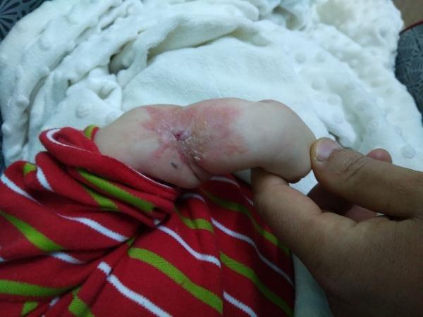 Minik çocuğun kolundaki yaranın sebebi bilinmiyor