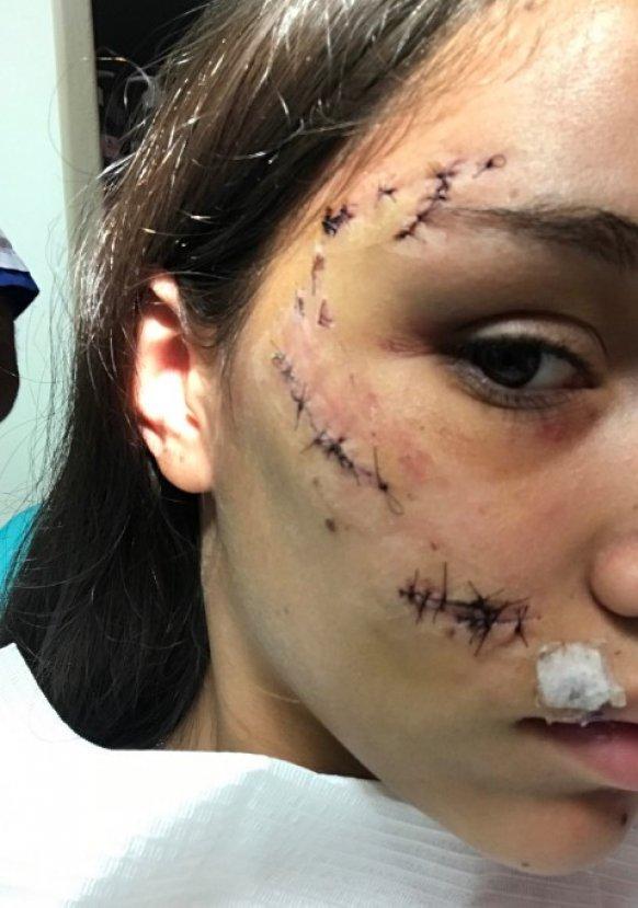 Köpekle fotoğraf çekmek isteyen genç kız yaralandı