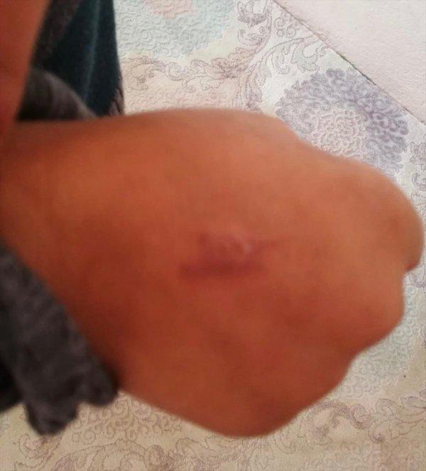 Siirt'te soba ızgarasıyla öğrencilere işkence