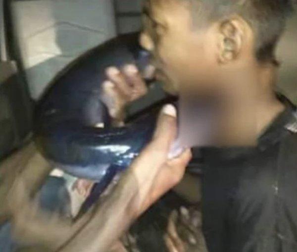 İğne balığı saldırısında bir çocuk yaralandı