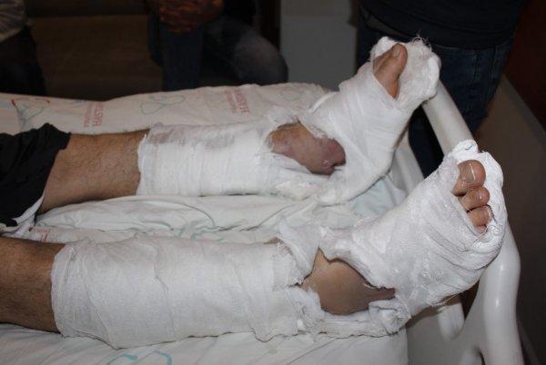 Depremden korkan adam, belinden ve bacaklarından oldu