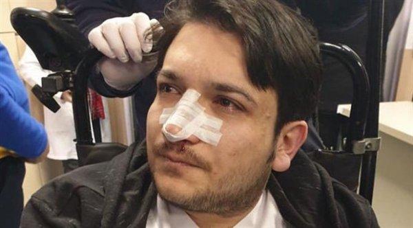 Doktorun burnunu kıran sanığa tahliye