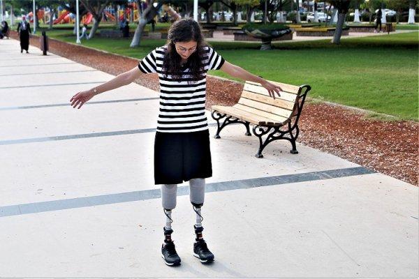 Buket Öğretmen'in protez bacakla ilk adım heyecanı