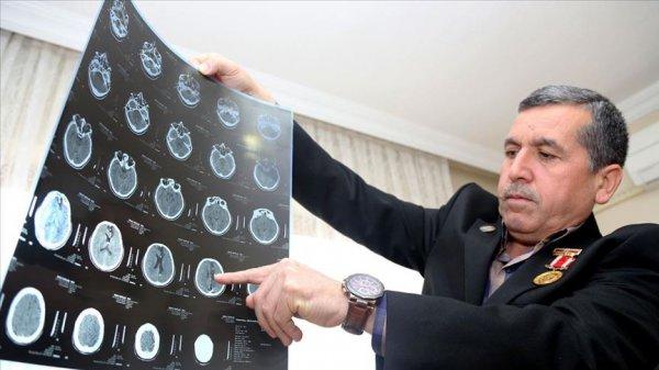 Gazi, 28 yıldır başındaki 14 şarapnel parçasıyla yaşıyor