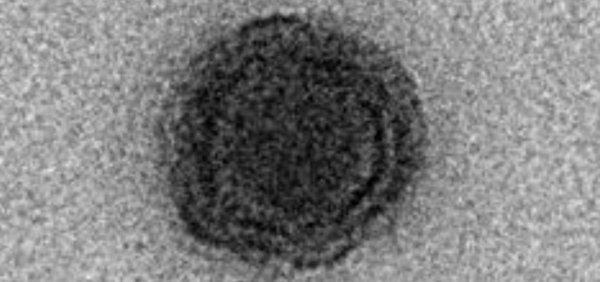 Brezilya'da amipleri hasta eden virüs bulundu