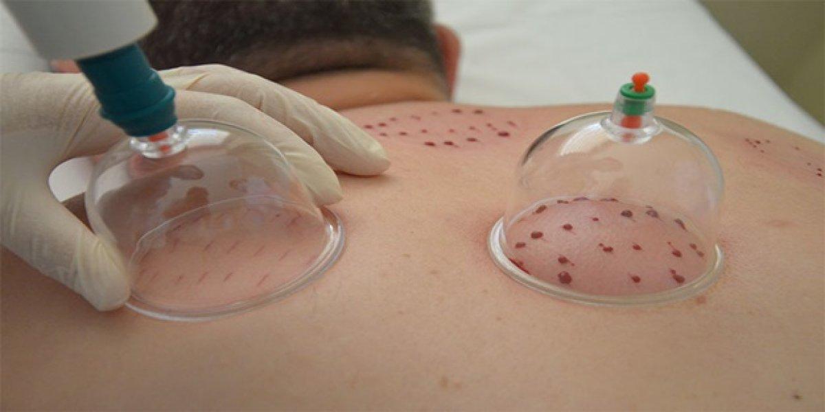 Hacamat yapan sahte doktora 20 ay hapis