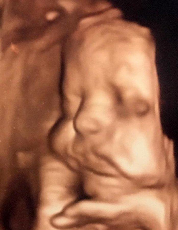 Anne karnındaki bebekler poz verdi