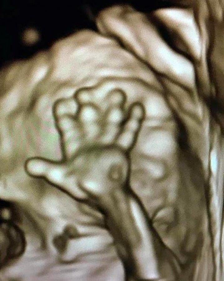 Anne karnındaki bebekler poz verdi