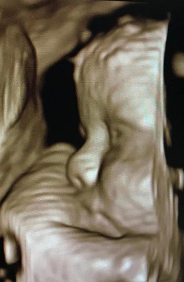 Anne karnındaki bebekler poz verdi