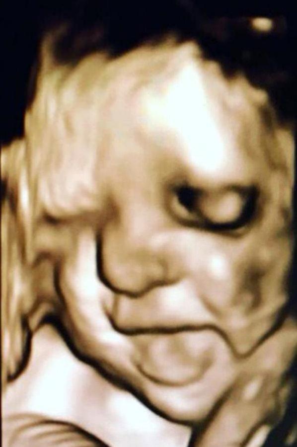 Anne karnındaki bebekler poz verdi