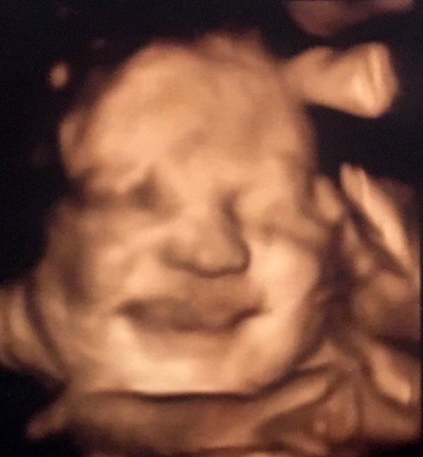 Anne karnındaki bebekler poz verdi