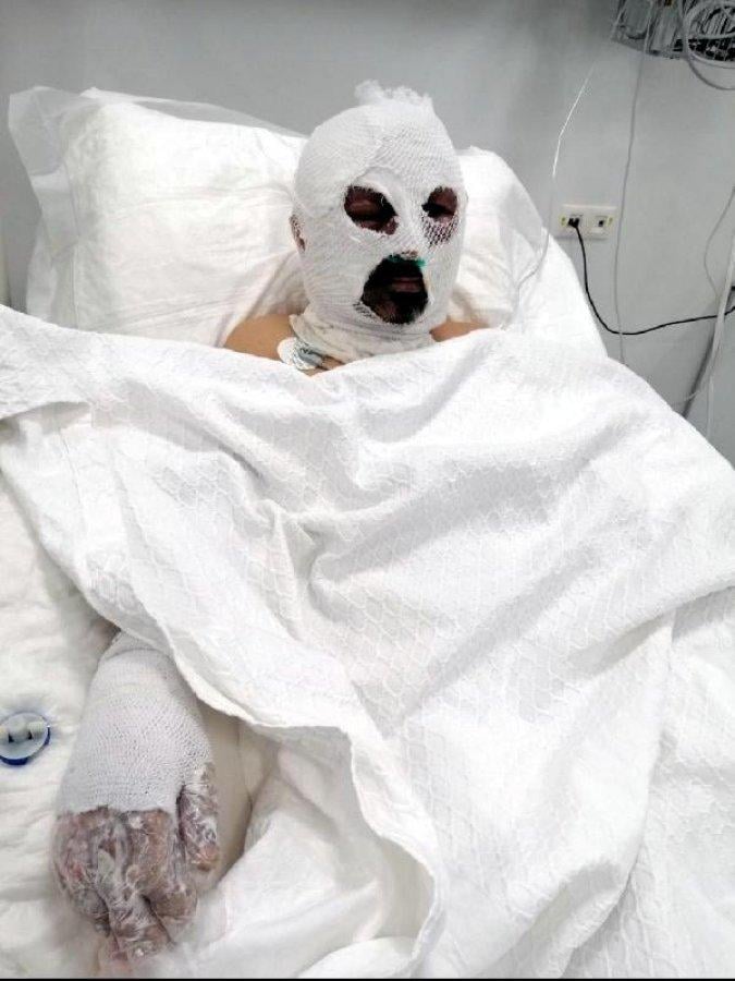 Öğrenci servisi şoförünün üzerine tiner döküp yaktı