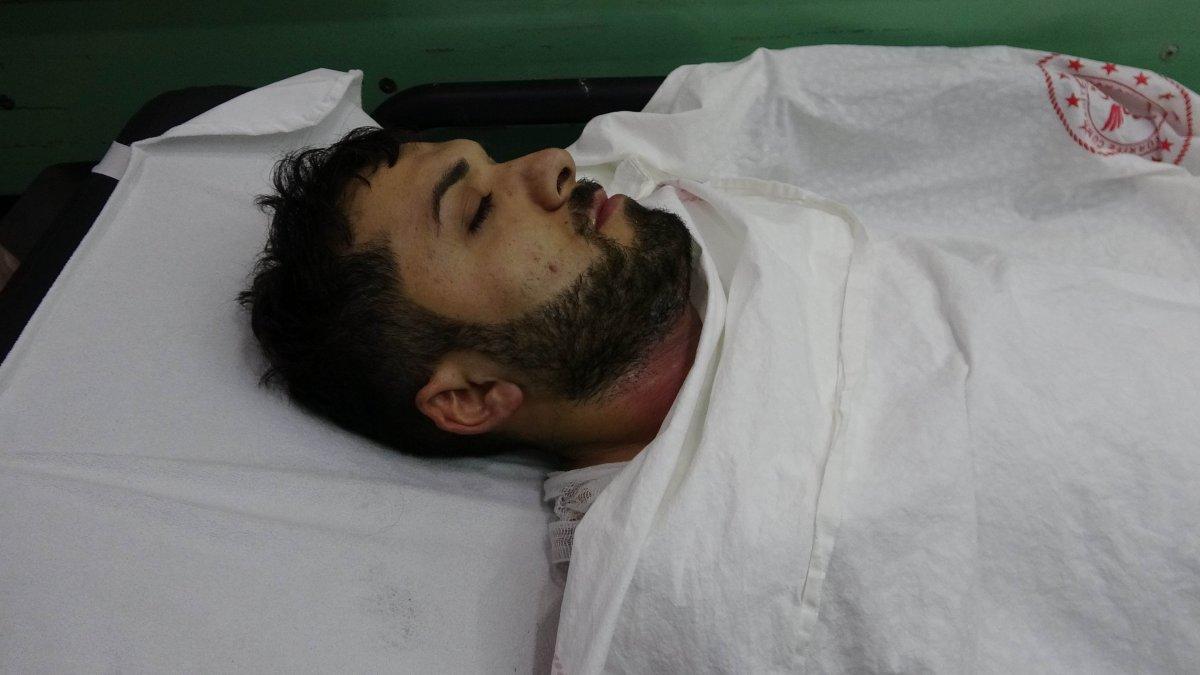 Samsun'da bir fabrikada 1'i ağır, 2 işçi yaralandı