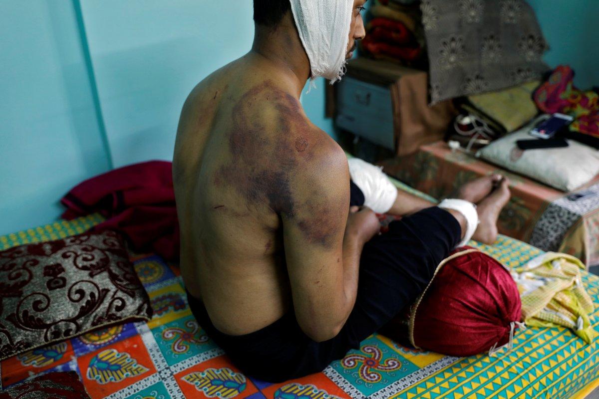 Hindistan'da öldüresiye dövülen Müslüman, dehşeti anlattı