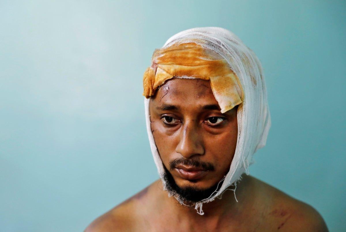 Hindistan'da öldüresiye dövülen Müslüman, dehşeti anlattı