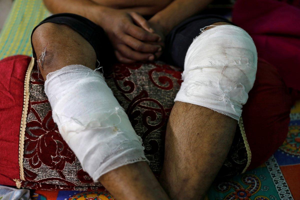 Hindistan'da öldüresiye dövülen Müslüman, dehşeti anlattı