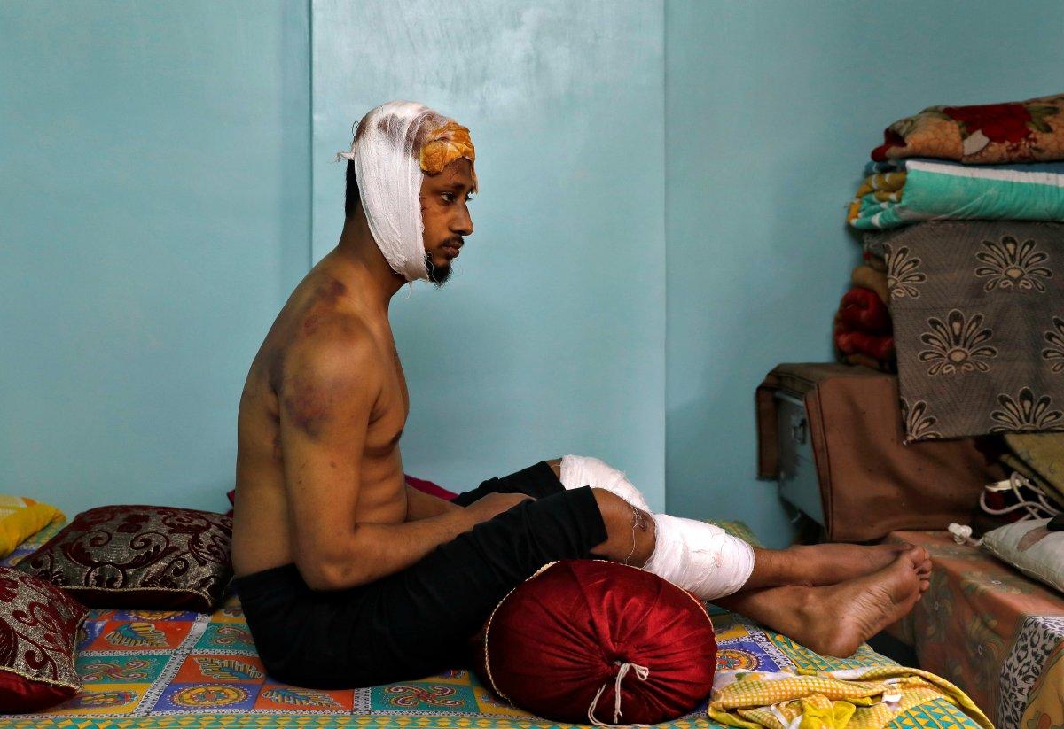 Hindistan'da öldüresiye dövülen Müslüman, dehşeti anlattı