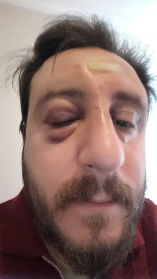 İstanbul'da gürültü tartışması apartmanı birbirine kattı