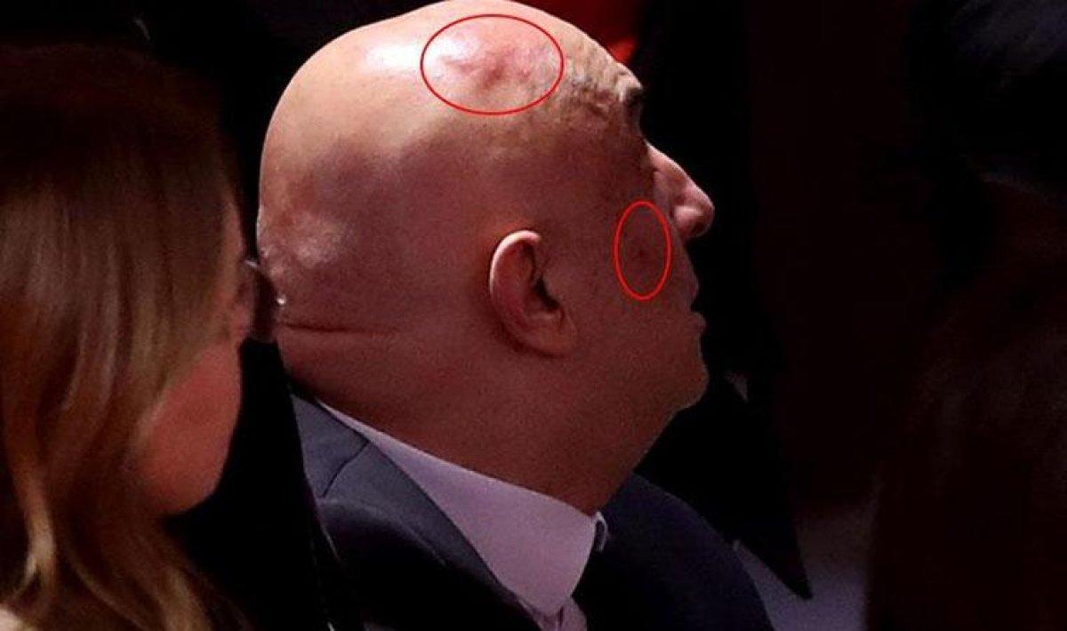 Kavga sonrası Engin Özkoç’un hali