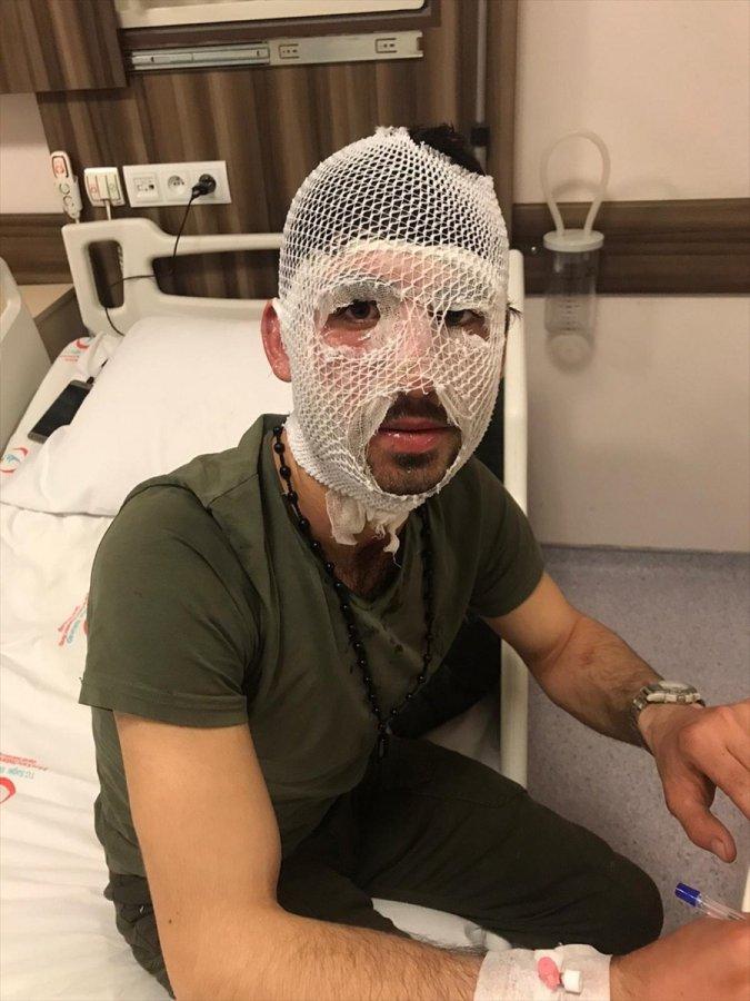 Yunan sınır polisi, sığınmacının üzerine kaynar su döktü