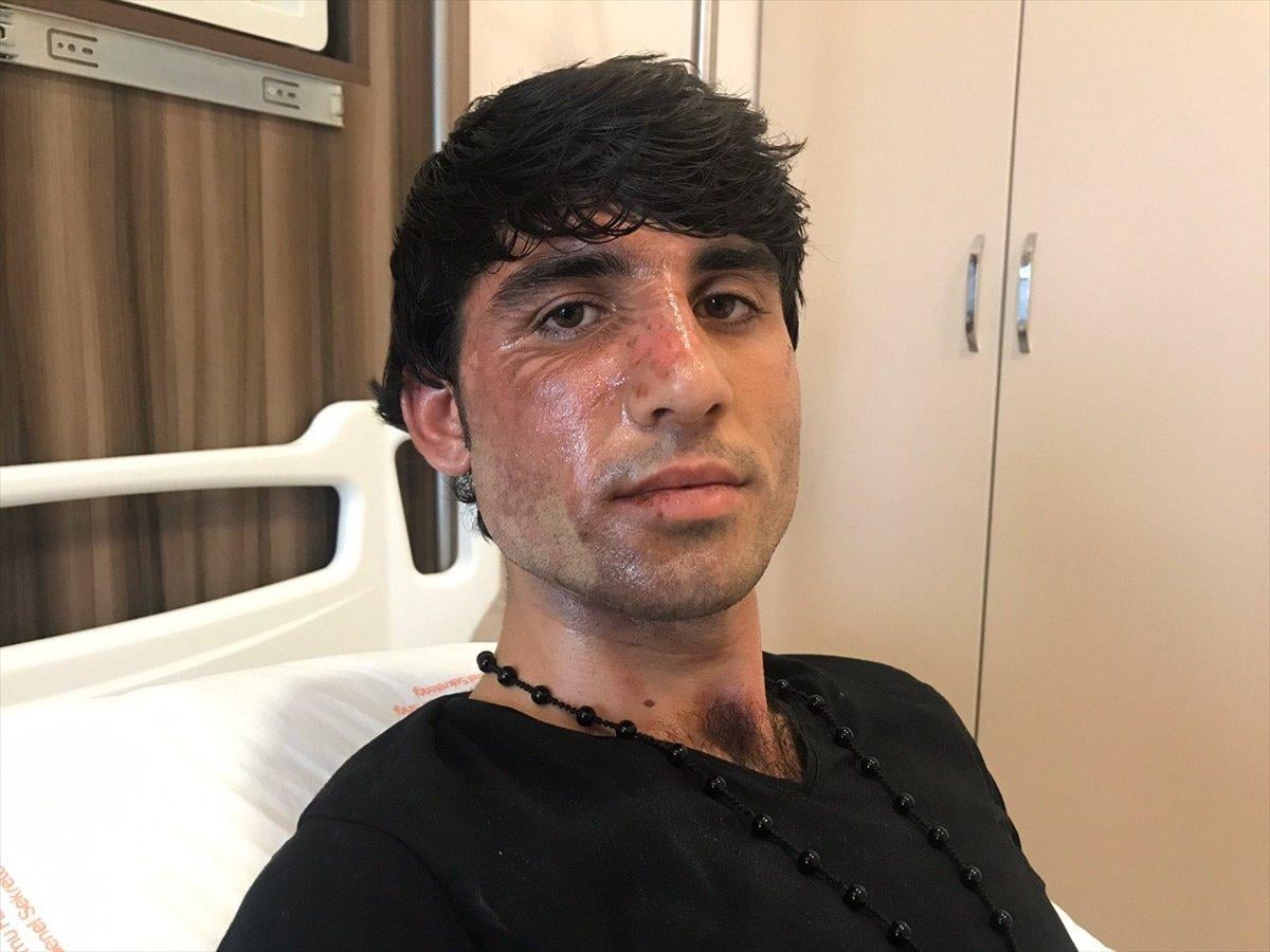 Yunan sınır polisi, sığınmacının üzerine kaynar su döktü