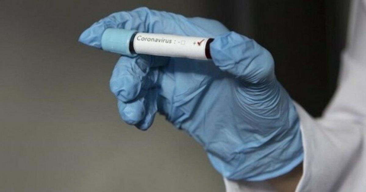 KKTC'ye 72 milyon liralık fınansal kaynak gönderildi