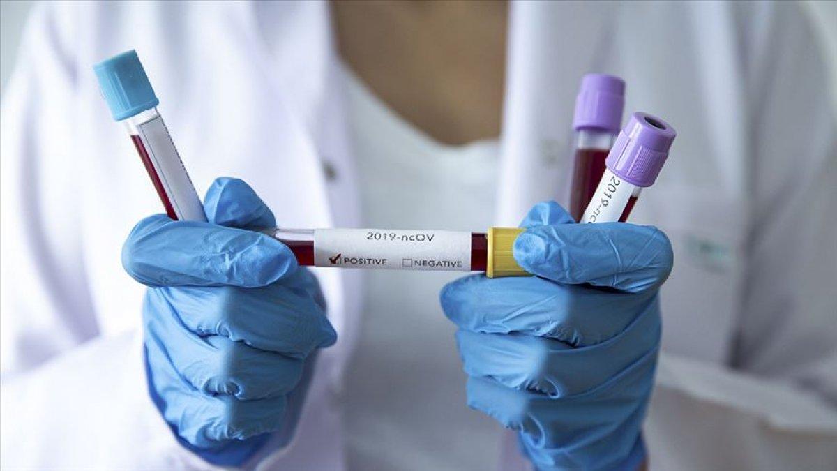 Koronavirüs olası vaka tanımına yeni madde eklendi