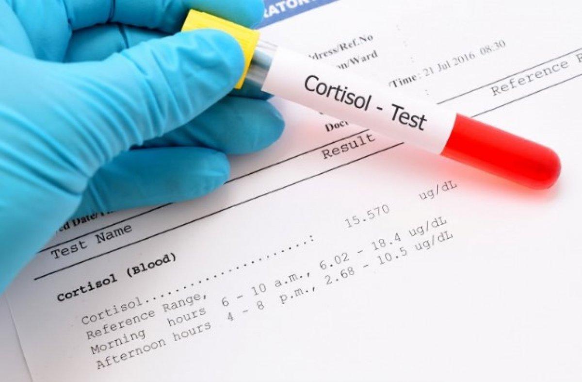 Kortizol nedir